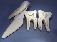(image for) Tooth, Biological Model (set of 3)