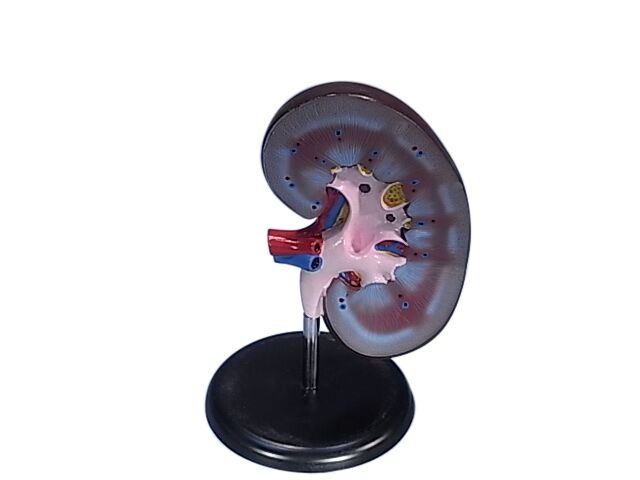 (image for) Model,Human Kidney